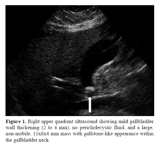 pancreas-quadrant-ultrasound