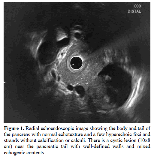 pancreas-radial-echoendoscopic-image