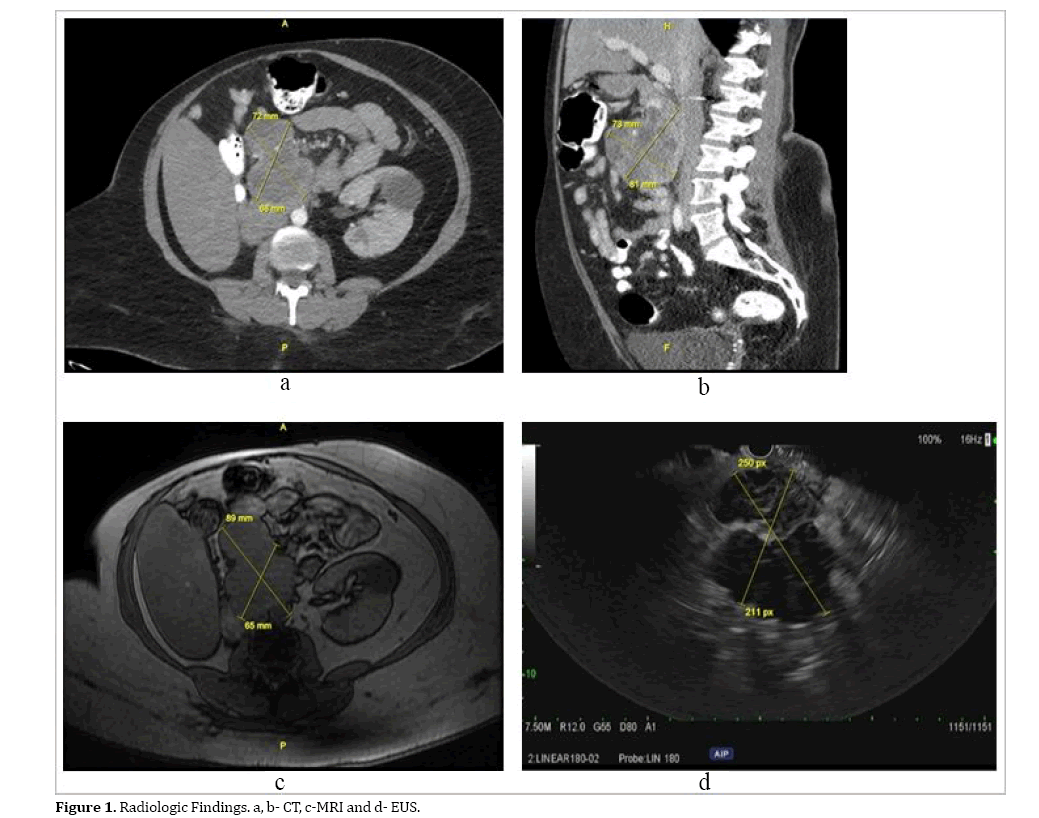 pancreas-radiologic-findings