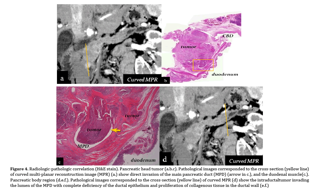 pancreas-radiologic-pathologic-correlation