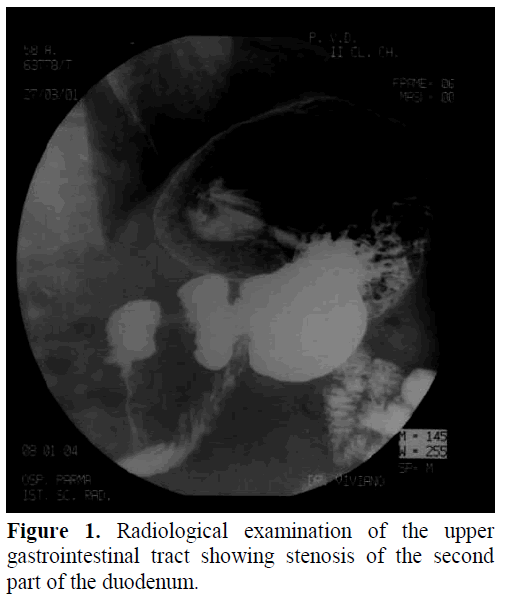 pancreas-radiological-examination-tract