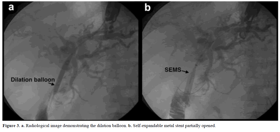 pancreas-radiological-image-demonstrating