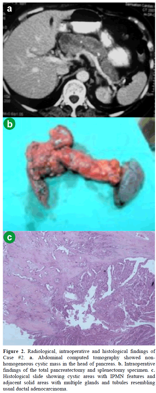 pancreas-radiological-intraoperative-findings