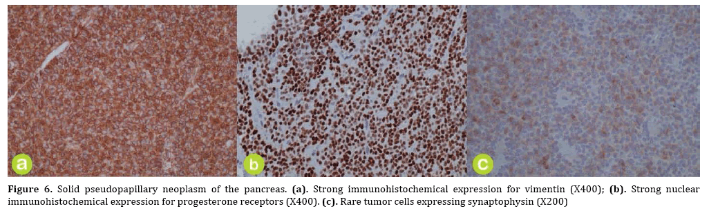 pancreas-receptors