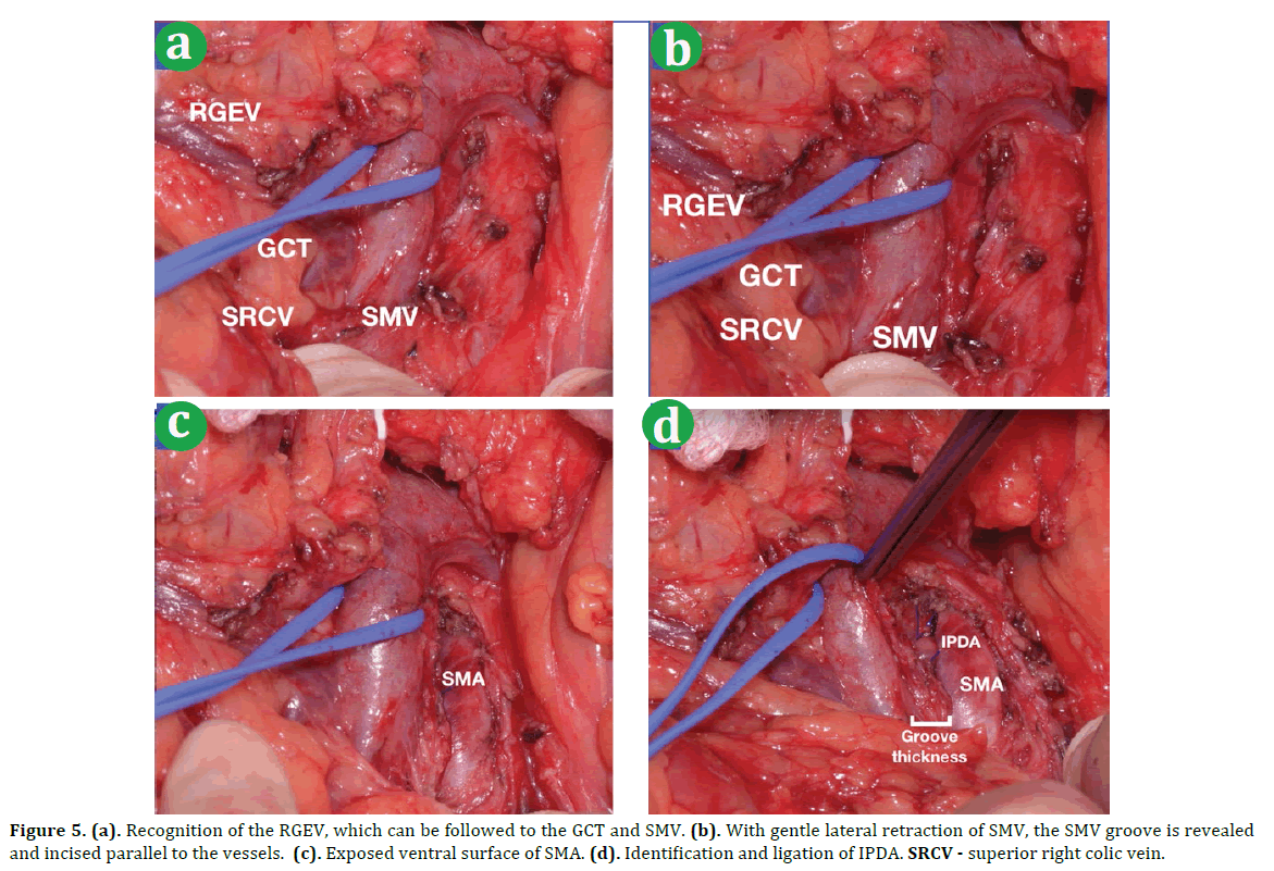 pancreas-recognition-rgev