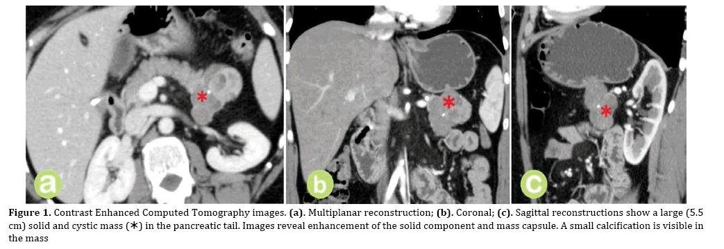 pancreas-reconstruction