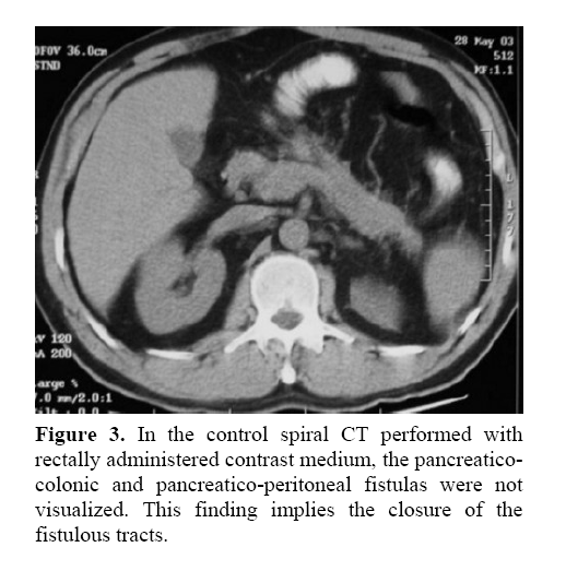 pancreas-rectally-administered-contrast