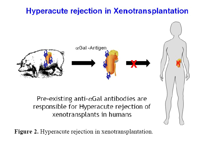 pancreas-rejection-xenotransplantation