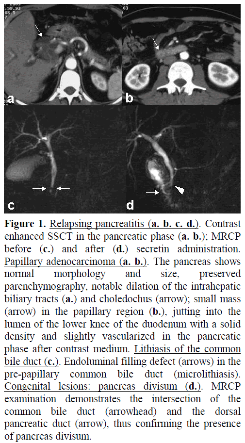 pancreas-relapsing-pancreatitis