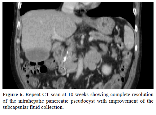 pancreas-repeat-ct-scan-resolution