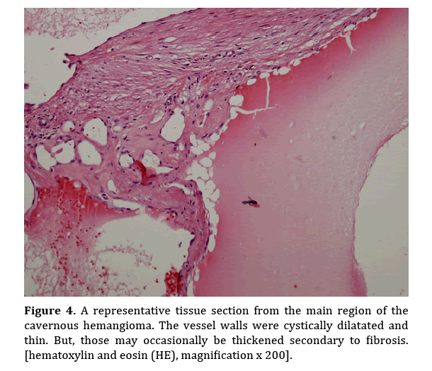 pancreas-representative-tissue-section