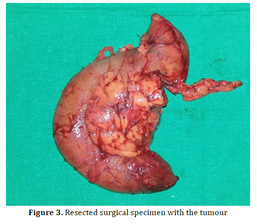 pancreas-resected-surgical-specimen