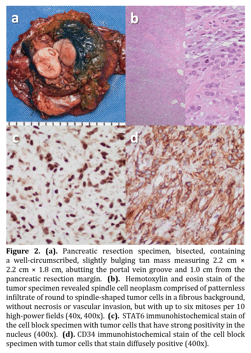 pancreas-resection-specimen