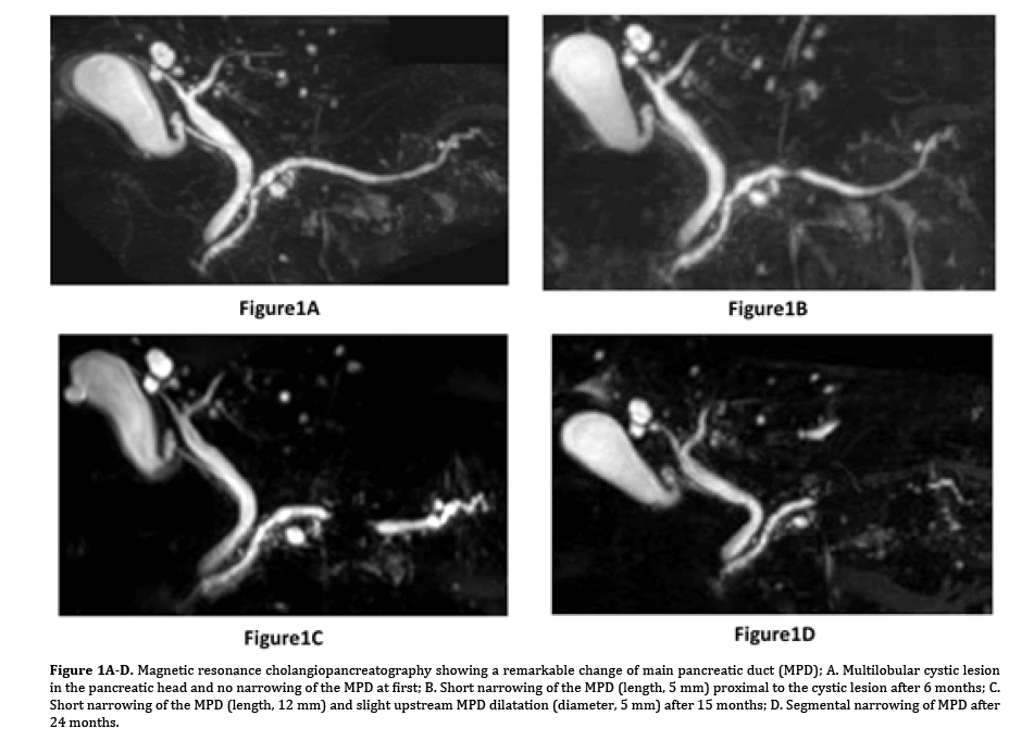 pancreas-resonance-cholangiopancreatography