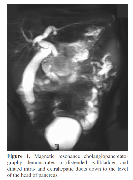 pancreas-resonance-cholangiopancreatography