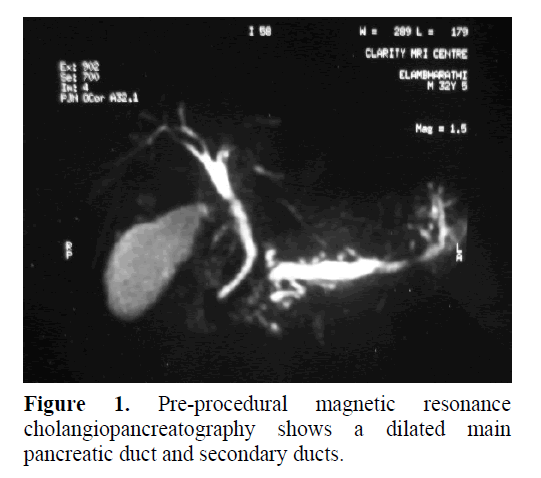 pancreas-resonance-cholangiopancreatography
