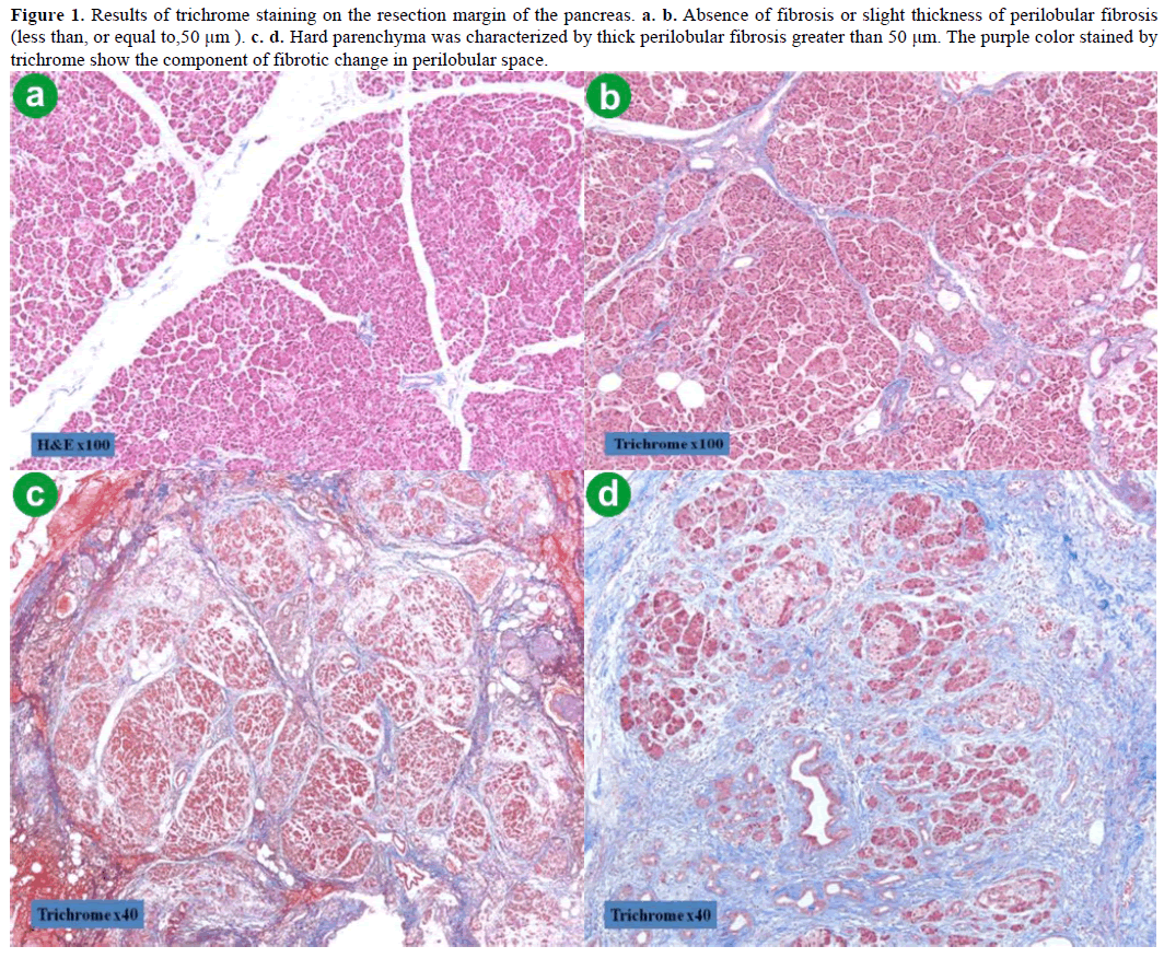 pancreas-results-trichrome-staining