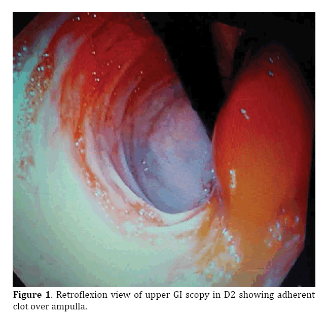 pancreas-retroflexion-view