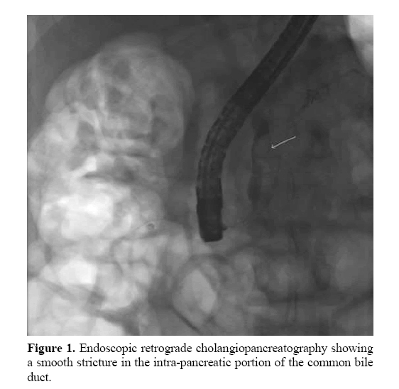 pancreas-retrograde-cholangiopancreatography