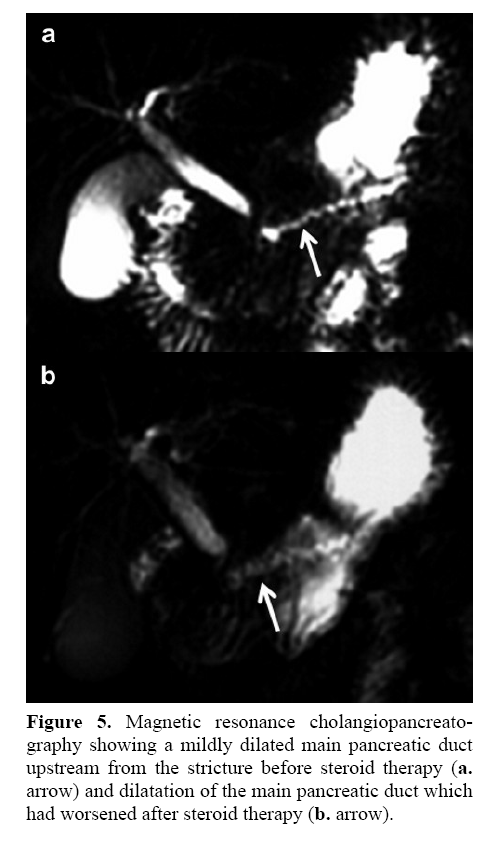 pancreas-retrograde-cholangiopancreatography