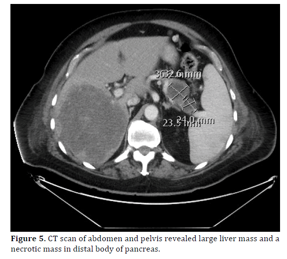 pancreas-revealed