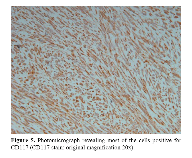 pancreas-revealing-most-cells-positive