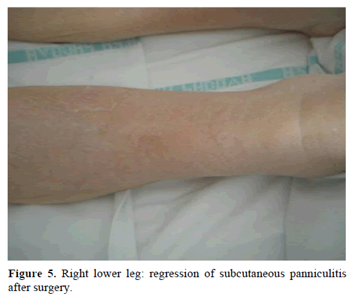 pancreas-right-lower-leg-regression