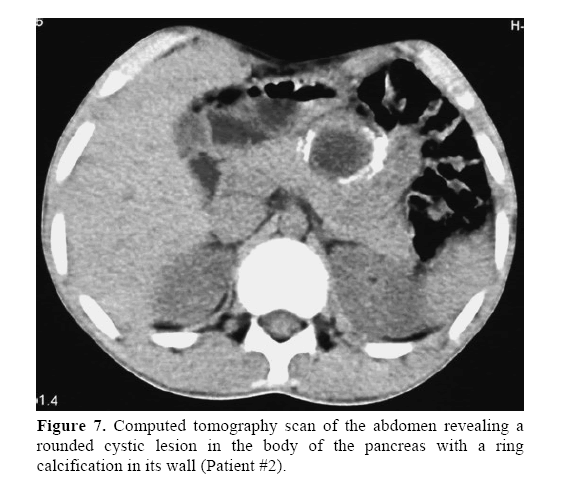 pancreas-rounded-cystic-lesion