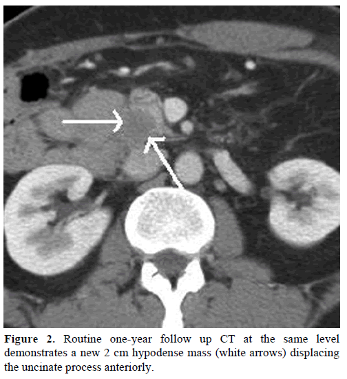 pancreas-routine-one-year-follow-up