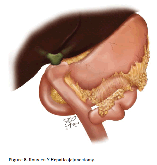 pancreas-roux