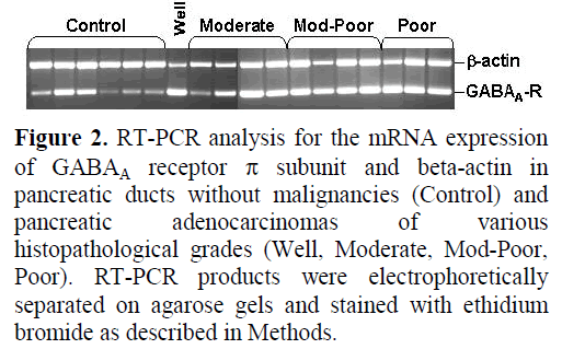 pancreas-rt-pcr-analysis-expression