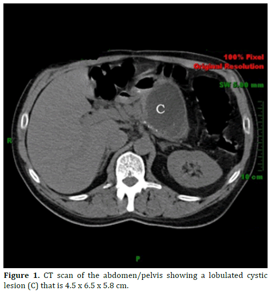 pancreas-scan-abdomen-pelvis