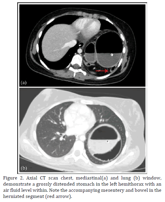 pancreas-scan-chest