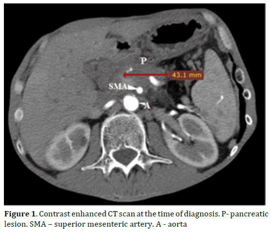 pancreas-scan-diagnosis-pancreatic