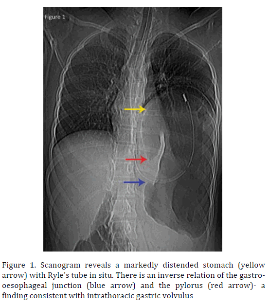 pancreas-scanogram-reveals