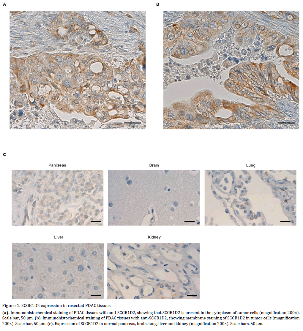 pancreas-scgb1d2-expression-tissues
