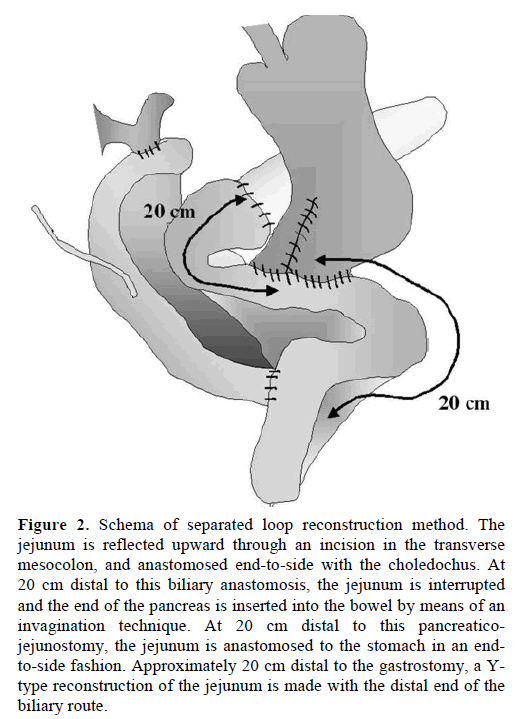pancreas-schema-loop-reconstruction