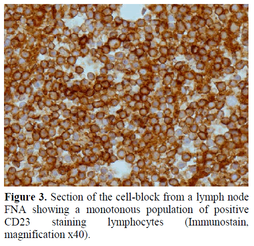 pancreas-section-cell-block-lymph