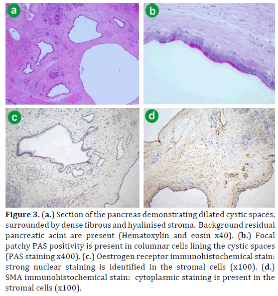 pancreas-section-pancreas-demonstrating