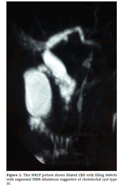 pancreas-segmental
