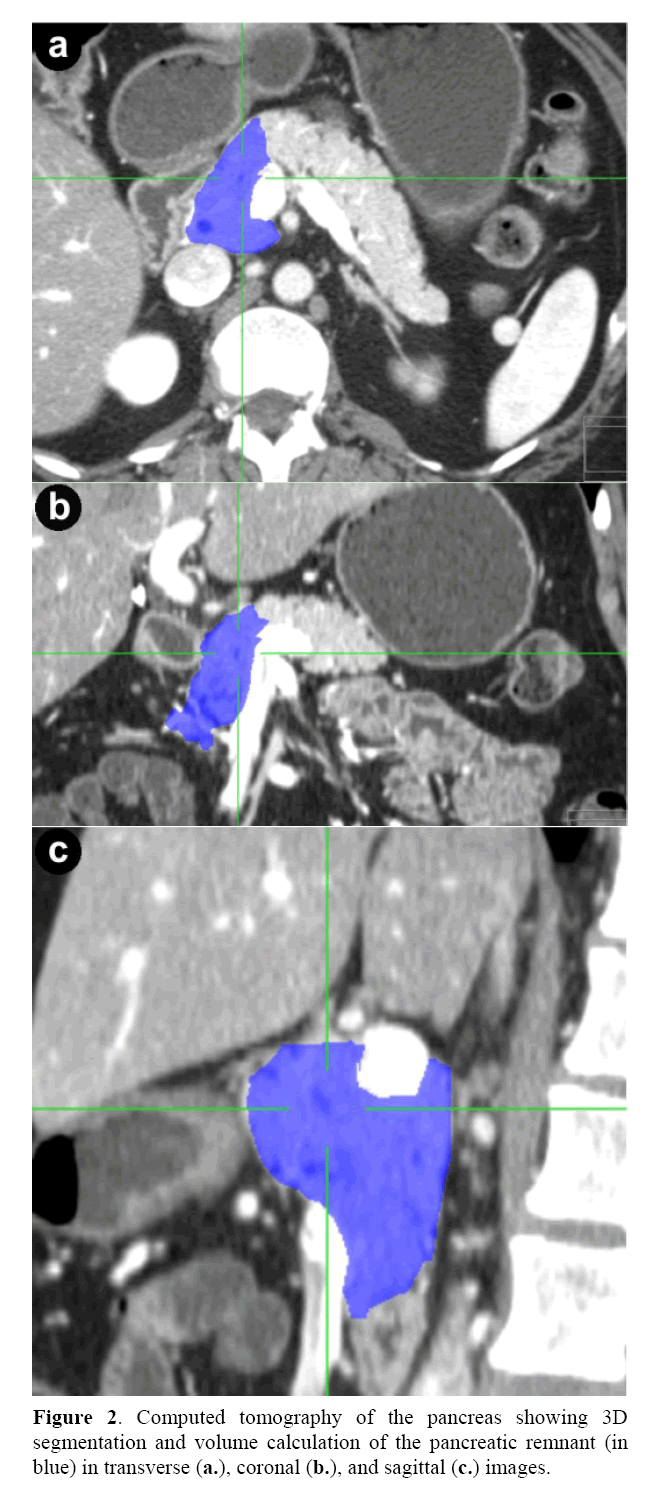 pancreas-segmentation-volume-calculation