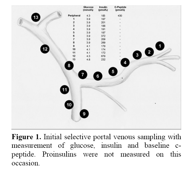 pancreas-selective-portal-venous