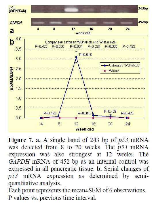 pancreas-semiquantitative-analysis