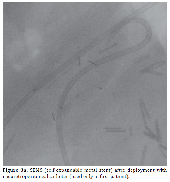 pancreas-sems-deployment