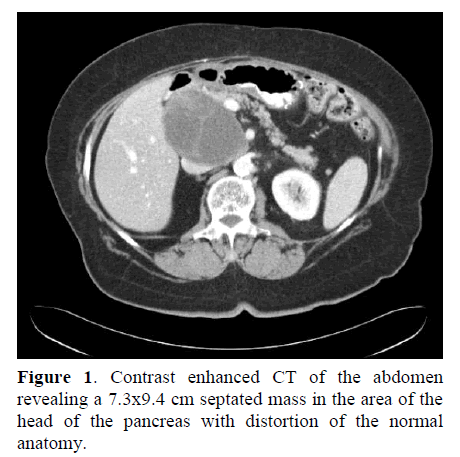 pancreas-septated-mass-area