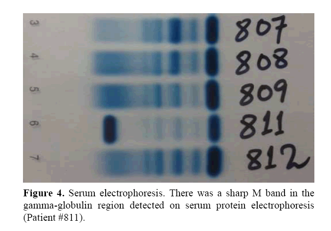 pancreas-serum-electrophoresis