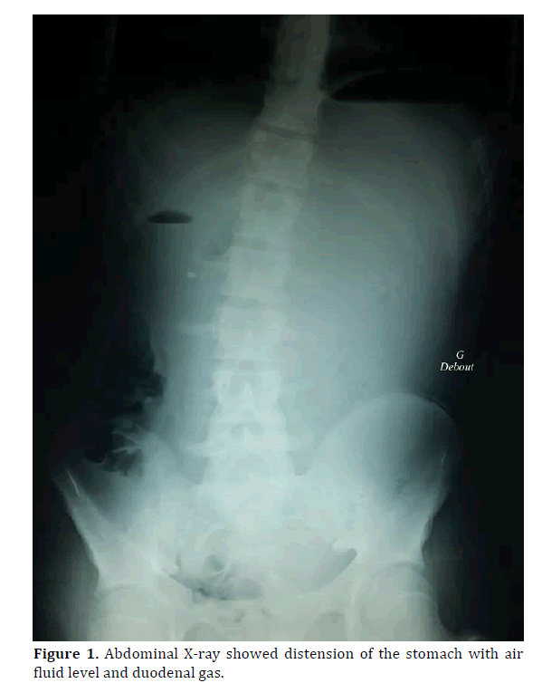 pancreas-showed-distension