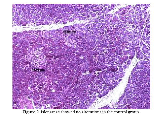 pancreas-showed-no-alterations