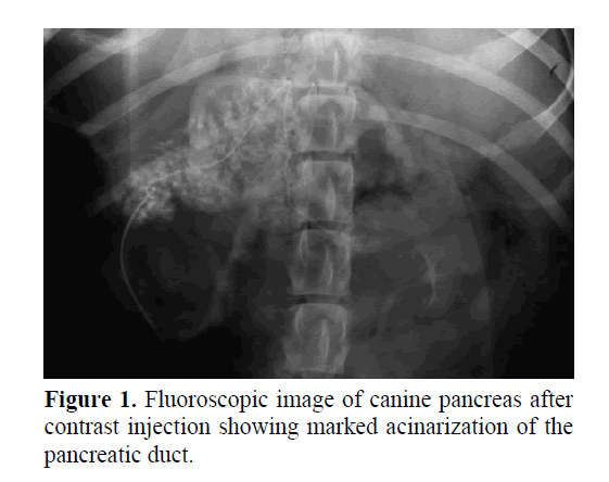pancreas-showing-marked-acinarization