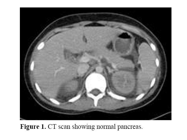 pancreas-showing-normal-pancreas